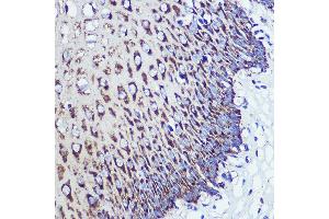Immunohistochemistry of paraffin-embedded Human esophageal using OSBPL8 Rabbit pAb (ABIN7269139) at dilution of 1:100 (40x lens). (OSBPL8 antibody  (AA 1-110))