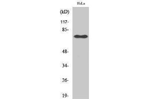 Western Blotting (WB) image for anti-Nuclear Factor-kB p65 (NFkBP65) (pSer529) antibody (ABIN3182089) (NF-kB p65 antibody  (pSer529))