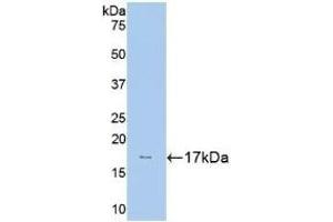 Detection of Recombinant HK1, Human using Polyclonal Antibody to Hexokinase 1 (HK1) (Hexokinase 1 antibody  (AA 80-215))