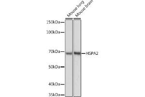 Western blot analysis of extracts of various cell lines, using HSP Rabbit mAb (ABIN7267579) at 1:1000 dilution. (HSPA2 antibody)