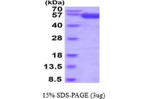 SDS-PAGE (SDS) image for Interleukin 18 Binding Protein (IL18BP) (AA 31-194) protein (hIgG-His-tag) (ABIN5854726) (IL18BP Protein (AA 31-194) (hIgG-His-tag))