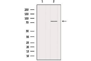 Western blot analysis of extracts from Mouse lung, using MECP2 Antibody. (MECP2 antibody  (C-Term))