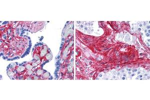 Immunohistochemistry (IHC) image for anti-Collagen, Type VI (COL6) antibody (HRP) (ABIN5596848)