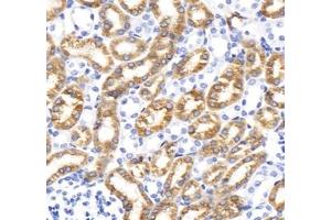 Immunohistochemistry analysis of paraffin-embedded rat duodenum using,STC (ABIN7075723) at dilution of 1: 800 (Stanniocalcin 1 antibody)