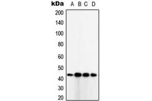 Western blot analysis of TUSC3 expression in SKBR3 (A), HeLa (B), HepG2 (C), MDAMB231 (D) whole cell lysates. (TUSC3 antibody  (Center))