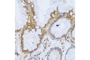 Immunohistochemistry of paraffin-embedded human stomach using GCC2 antibody (ABIN6130422, ABIN6141007, ABIN6141008 and ABIN6217941) at dilution of 1:150 (40x lens).