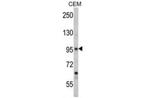 Western blot analysis of SEA Antibody (Center) (ABIN392177 and ABIN2841890) in CEM cell line lysates (35 μg/lane).