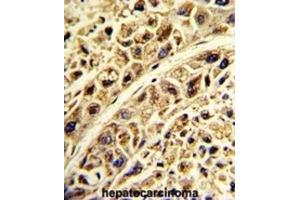 Immunohistochemistry (IHC) image for anti-Proline Arginine Rich End Leucine Rich Repeat Protein (PRELP) antibody (ABIN3002740) (PRELP antibody)