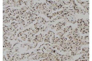 ABIN6267147 at 1/100 staining Human lung tissue by IHC-P. (NUMA1 antibody  (pSer395))