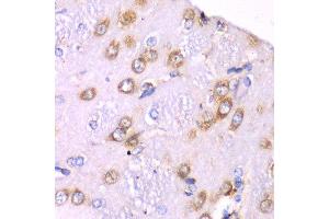 Immunohistochemistry of paraffin-embedded rat brain using RPS3A Antibody. (RPS3A antibody  (AA 1-264))