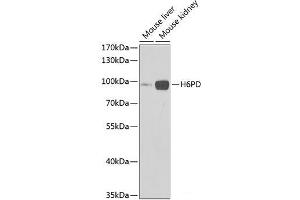 Western blot analysis of extracts of various cell lines using H6PD Polyclonal Antibody at dilution of 1:1000. (Glucose-6-Phosphate Dehydrogenase antibody)