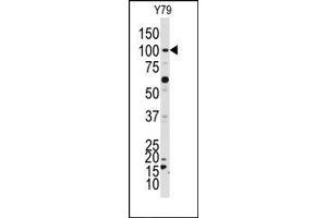 Image no. 1 for anti-NIMA related kinase 4 (NEK4) (C-Term) antibody (ABIN360540) (NEK4 antibody  (C-Term))