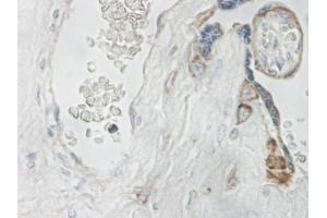 Image no. 1 for anti-Interleukin 15 (IL15) antibody (ABIN464931) (IL-15 antibody)