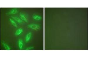 Immunofluorescence analysis of HeLa cells, using Keratin 18 Antibody. (Cytokeratin 18 antibody  (AA 381-430))