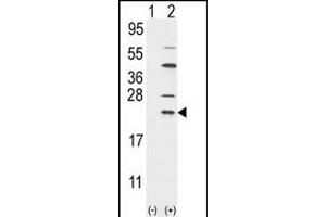 Western blot analysis of UBE2C (arrow) using rabbit polyclonal UBE2C Antibody (N-term G25) (ABIN388856 and ABIN2839158). (UBE2C antibody  (N-Term))