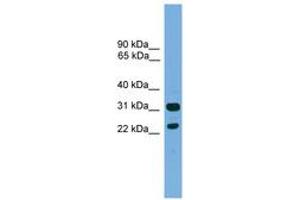 Image no. 1 for anti-CD8b Molecule (CD8B) (C-Term) antibody (ABIN6745592) (CD8B antibody  (C-Term))