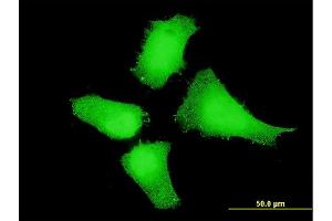 Immunofluorescence of monoclonal antibody to MAP2K5 on HeLa cell. (MAP2K5 antibody  (AA 1-120))