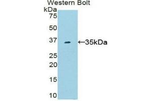 Western Blotting (WB) image for anti-Signal Transducer and Activator of Transcription 6, Interleukin-4 Induced (STAT6) (AA 557-841) antibody (ABIN3206147) (STAT6 antibody  (AA 557-841))