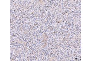 IHC analysis of ANGPT2 using anti-ANGPT2 antibody (ABIN3043725). (Angiopoietin 2 antibody  (AA 19-348))