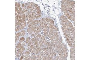 Immunohistochemical staining of human heart muscle with FAM184A polyclonal antibody  shows moderate cytoplasmic positivity in myocytes at 1:200-1:500 dilution.