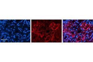 Rabbit Anti-AQP2 Antibody   Formalin Fixed Paraffin Embedded Tissue: Human Kidney Tissue Observed Staining: Cytoplasm Primary Antibody Concentration: 1:100 Other Working Concentrations: 1:600 Secondary Antibody: Donkey anti-Rabbit-Cy3 Secondary Antibody Concentration: 1:200 Magnification: 20X Exposure Time: 0. (AQP2 antibody  (Middle Region))