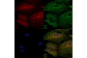 ABIN6262287 and ABIN6276673 staining  cells by IF/ICC.
