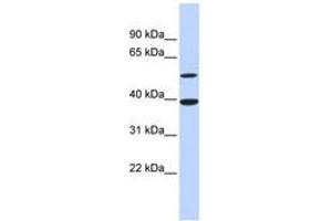 Image no. 1 for anti-Activating Transcription Factor 7 (AFT7) (AA 71-120) antibody (ABIN6744399) (AFT7 antibody  (AA 71-120))
