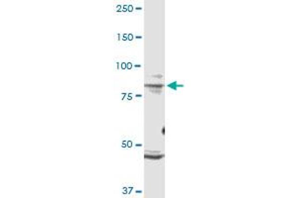 TRPV1 antibody  (AA 21-124)