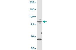 TRPV1 monoclonal antibody (M01), clone 1F5. (TRPV1 antibody  (AA 21-124))