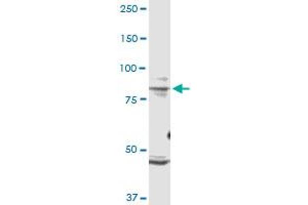 TRPV1 anticorps  (AA 21-124)