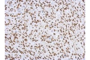 IHC-P Image Immunohistochemical analysis of paraffin-embedded C2C12 xenograft, using Lamin A + C, antibody at 1:500 dilution. (Lamin A/C antibody)