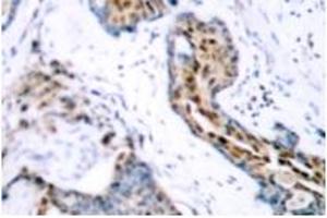 Image no. 2 for anti-Estrogen Receptor 1 (ESR1) (pSer118) antibody (ABIN318018) (Estrogen Receptor alpha antibody  (pSer118))