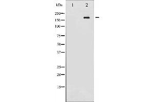 Western blot analysis of Ret phosphorylation expression in K562 whole cell lysates,The lane on the left is treated with the antigen-specific peptide.