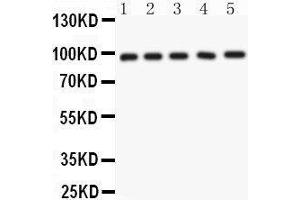 Anti- NUP98 Picoband antibody, Western blotting All lanes: Anti NUP98  at 0. (NUP98 antibody  (AA 549-880))