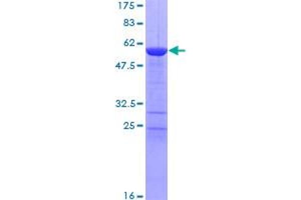 Tropomyosin Protein (AA 1-245) (GST tag)