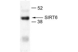 U2OS (SIRT6 antibody  (N-Term))
