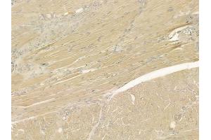 ABIN6265892 and ABIN6276955 at 1/100 staining human tongue carcinoma by IHC-P. (Uromodulin antibody  (C-Term))
