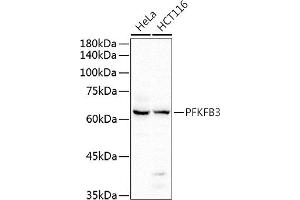 PFKFB3 Antikörper  (AA 400-500)