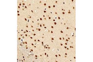 Immunohistochemistry of paraffin embedded rat brain using smad62024 (ABIN7075629) at dilution of 1:1500 (400x lens) (SMAD6 antibody)