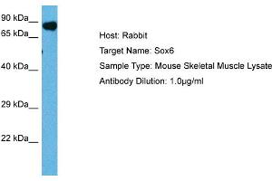 Host: Mouse Target Name: SOX6 Sample Tissue: Mouse Skeletal Muscle Antibody Dilution: 1ug/ml (SOX6 antibody  (Middle Region))