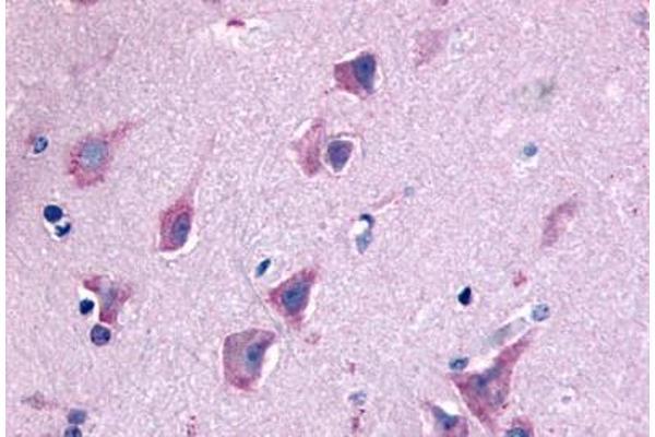 QRFPR antibody  (N-Term)