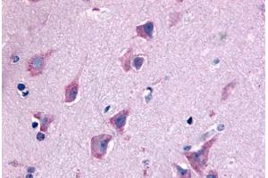 Anti-QRFPR / GPR103 antibody  ABIN1049284 IHC staining of human brain, neurons and glia.