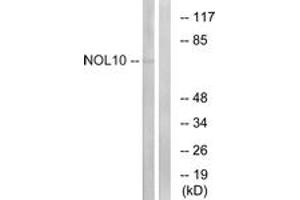 Western blot analysis of extracts from HuvEc cells, using NOL10 Antibody. (NOL10 antibody  (AA 639-688))