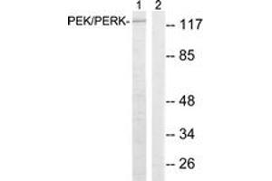 Image no. 2 for anti-Eukaryotic Translation Initiation Factor 2-alpha Kinase 3 (EIF2AK3) (AA 947-996) antibody (ABIN2889115) (PERK antibody  (AA 947-996))
