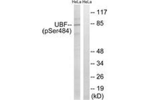 Western blot analysis of extracts from HeLa cells treated with calyculinA 50ng/ml 30', using UBF (Phospho-Ser484) Antibody. (UBTF antibody  (pSer484))