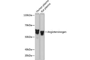 Western Blotting (WB) image for anti-Angiotensinogen (serpin Peptidase Inhibitor, Clade A, Member 8) (AGT) antibody (ABIN7265598)