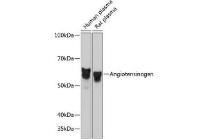 Western blot analysis of extracts of various cell lines, using Angiotensinogen Rabbit mAb (ABIN7265598) at 1:1000 dilution. (AGT antibody)