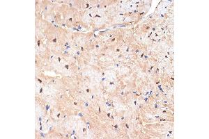 Immunohistochemistry of paraffin-embedded mouse heart using sestrin 1 Rabbit mAb (ABIN7270259) at dilution of 1:100 (40x lens). (SESN1 antibody)