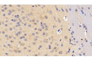 Detection of DLG4 in Mouse Cerebrum Tissue using Polyclonal Antibody to Discs, Large Homolog 4 (DLG4) (DLG4 antibody  (AA 1-393))