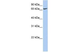WB Suggested Anti-ATP6V0A1 Antibody Titration:  0. (ATP6V0A1 antibody  (N-Term))
